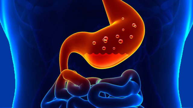 Gejala Asam Lambung dan Penyebabnya yang Perlu Kalian Perhatikan